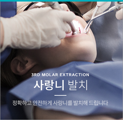 사랑니발치